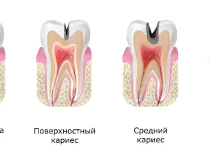 Как выбрать детскую зубную пасту?